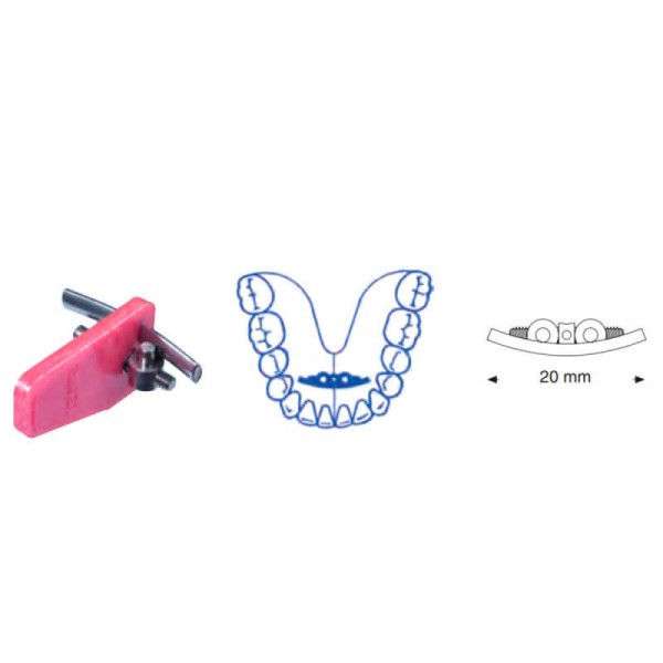 Mandibular Bow Expansion Screw, 20mm