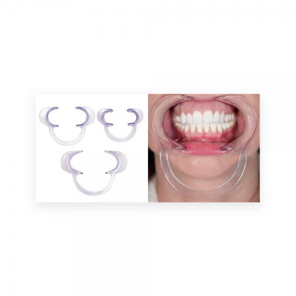 Retractor Extraoral, Adult, PK/2