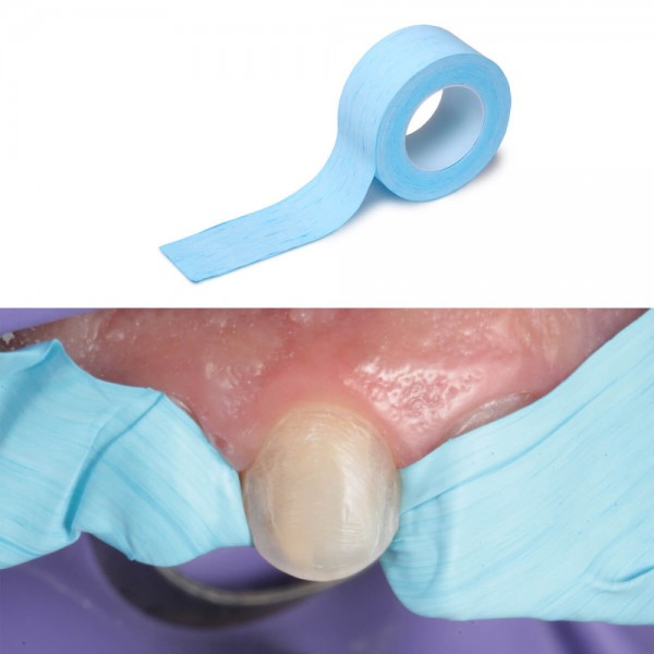 IsoTape, Teeth Isolation Tape, 5μm