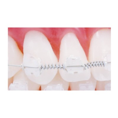 Tooth Tone NiTi Open Coil Spring, 014x032, PK/3