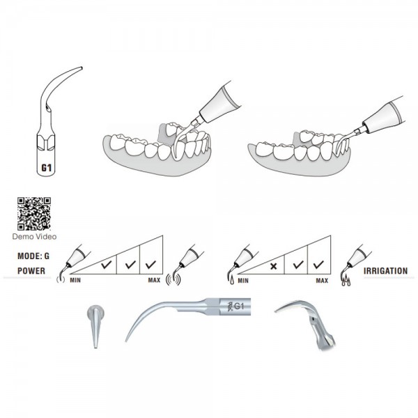 G1 Woodpecker Scaler Tip, Removal of Supragingival Deposits