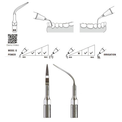 G3 Woodpecker Scaler Tip, Removal of Supragingival Deposit and Interproximal