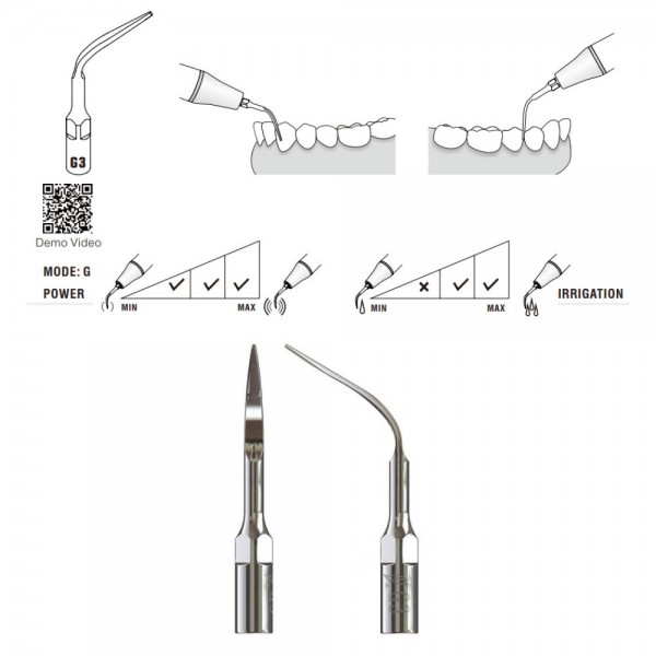 G3 Woodpecker Scaler Tip, Removal of Supragingival Deposit and Interproximal