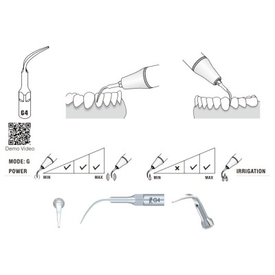 G4 Woodpecker Scaler Tip, Treatment of Interproximal Spaces and Supragingival Scaling